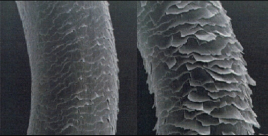 cuticle